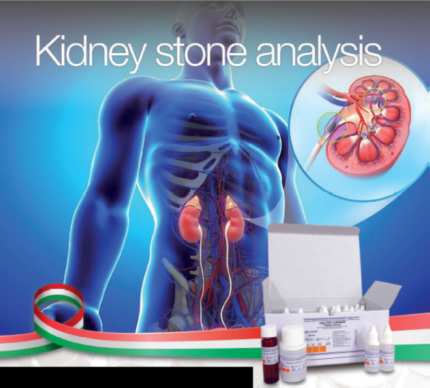 LTA Kidney Stone Analysis - ELITechGroup Australia & New Zealand